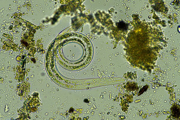 N&eacute;matodes, vers filiformes, &eacute;chantillon de sol